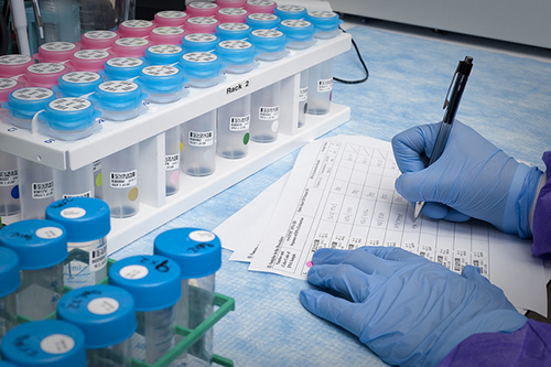 靶向Kindlin-1避免乳腺癌肺转移