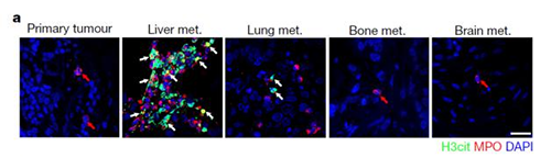 转入小鼠模子获得相同的试验效果，，，，，且在转移爆发前NET已在肝脏聚积。。。