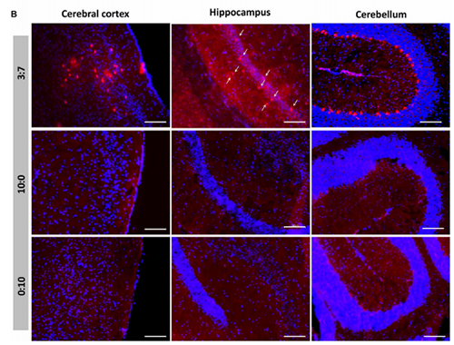 被包裹在含有NT-类脂质的LNP中的Cre重组酶乐成转移。。。。。大脑中的转染神经元呈红色高亮。。。。。