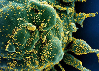 唾液检测新冠抗体新要领来了，，，，，，，，获取效果仅需几小时！