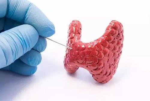 甲状腺疾病，，，，，，，，包括甲状腺功效减退和甲状腺功效亢进，，，，，，，，自古以来就是重复被医学研究职员研究的疾病